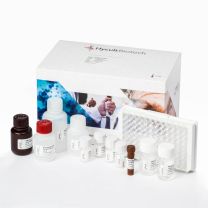 Arginase-I, Human, ELISA kit – 1 x 96 det. - HK386-01