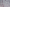 Beta-3 integrin subunit, Human, mAb BV4 – 100 µg - HM2035-100UG