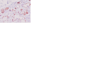 Beta-defensin 2, Human, pAb – 20 µg - HP9057-20UG